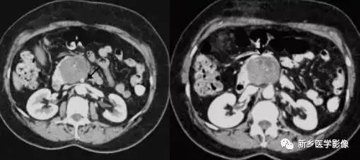 18种疾病包括哪些,18种肿瘤有哪些