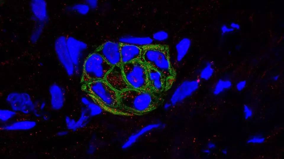 意义非凡！广州医科大学唐道林教授团队发现治疗胰腺癌的新药物和新机制｜科学大发现