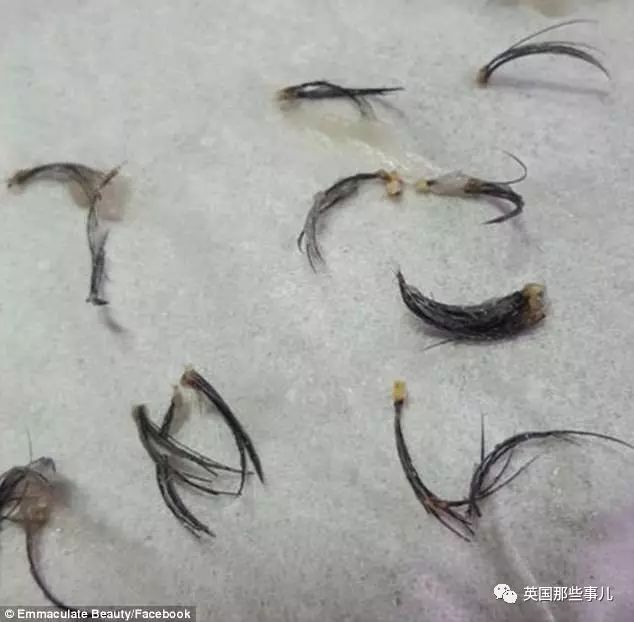 她想植人工睫毛，却搞到自然睫毛全掉光……看到这一切，连植睫专家都忍不住了