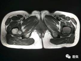 髋部疼痛做什么检查,左髋部疼痛待查病例
