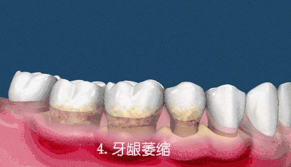 爱牙口腔日,爱牙日华西口腔医院