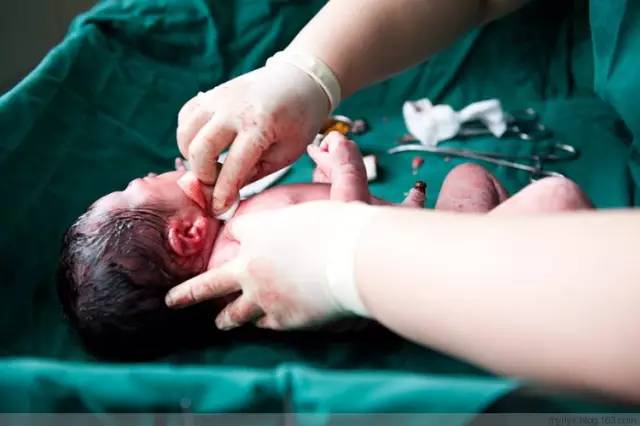 剖腹产全景记录,剖腹产恢复不同时期的照片