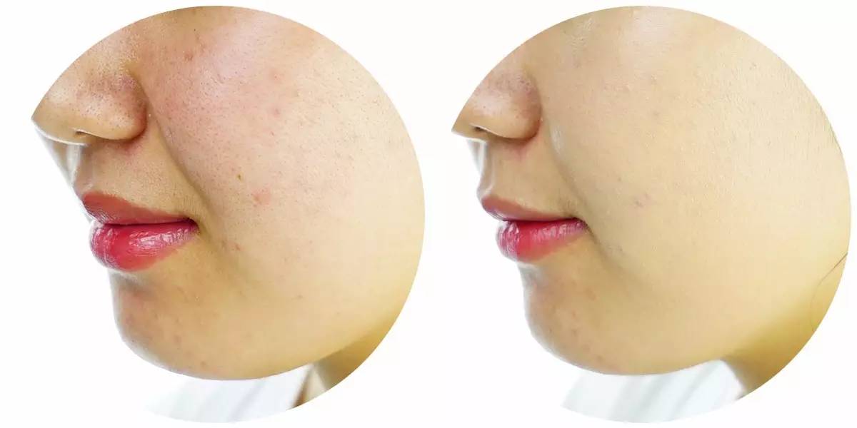 大牌粉底和平价粉底有什么区别,平价粉底和大牌粉底差距在哪里