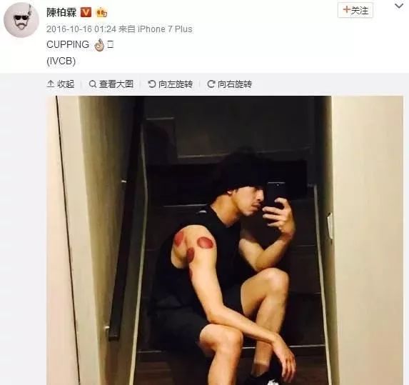 让众多明星痴迷的神秘东方医术!快来get明星同款!