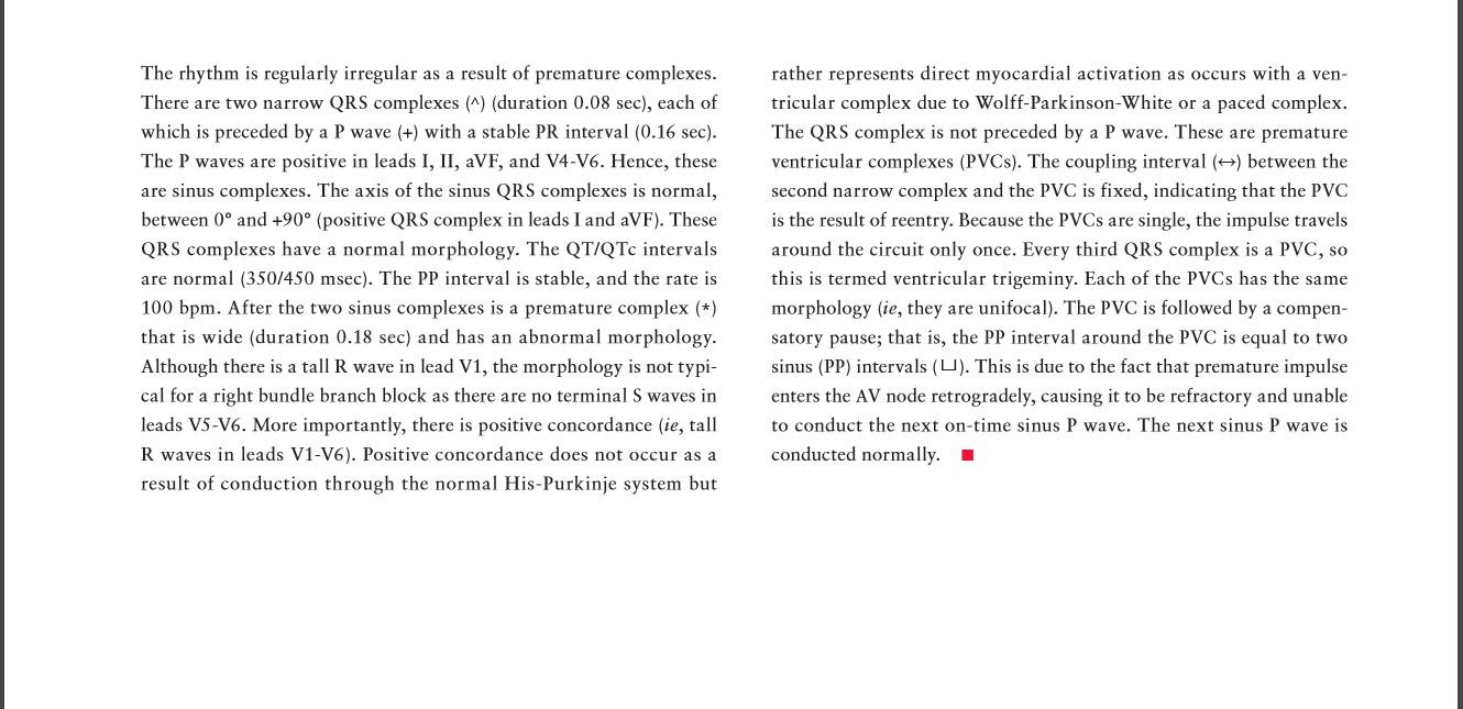 室早三联律是什么原因造成的,读心有术讲的是什么