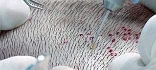 沙溢火吗,沙溢火了