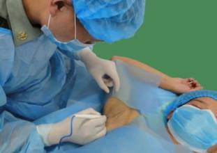 夏天狐臭出汗怎么消除,夏天腋下出汗有异味是狐臭吗