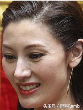 眼睛保养的最佳方法,眼睛如何保养年轻