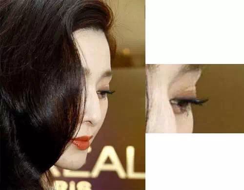 杨幂眼皮松弛怎么补救的,杨幂眼睛肿了怎么回事