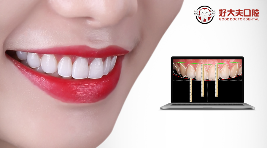 牙齿黑色污垢怎么去除有小窍门,牙齿黑色污垢怎么有效去除