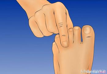 夏季手上起小水泡脱皮要怎样解决,为什么一到夏天就手脱皮