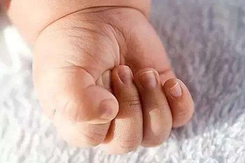 给婴儿剪脚指甲怎么预防甲沟炎,宝宝甲沟炎如何剪脚趾甲