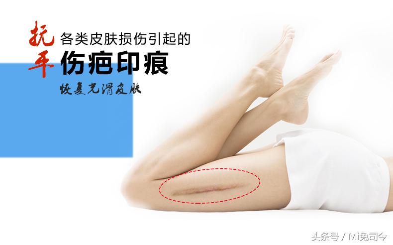 祛疤没有什么风险吧,疤痕祛疤最好的方法