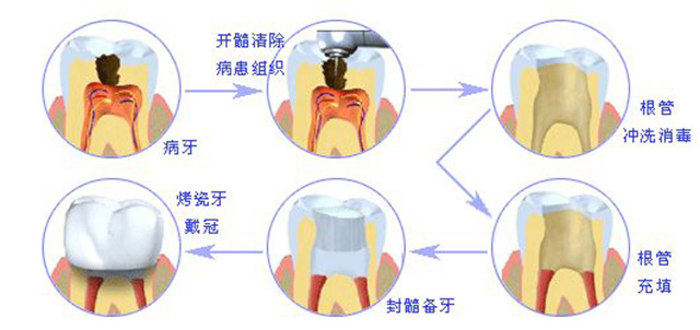 牙齿不舒服引起牙痛怎么办,坐飞机牙痛是怎么回事