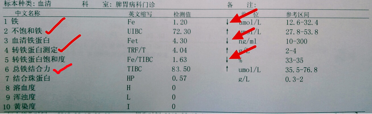 血常规报告单数据可以看出贫血,地中海贫血的血常规报告单怎么看