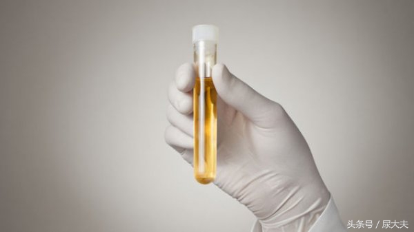 尿路感染应怎么预防,尿路感染是什么症状如何缓解