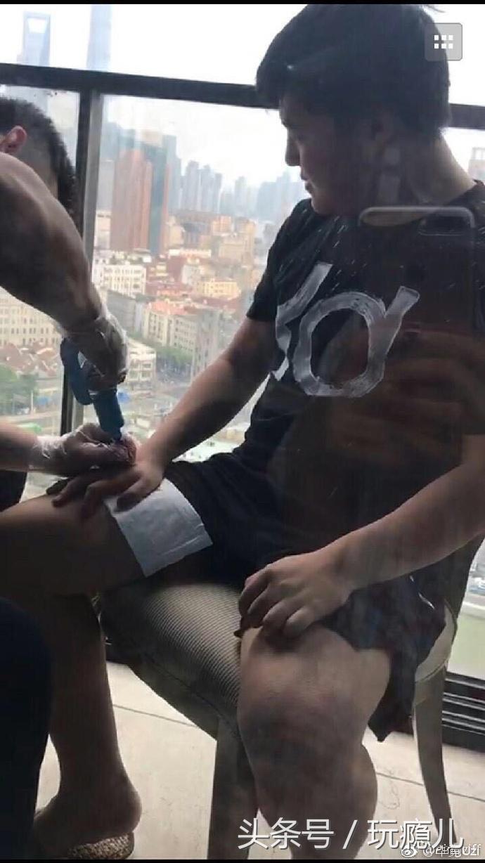 uzi的手是腱鞘炎吗,uzi治疗背部伤病