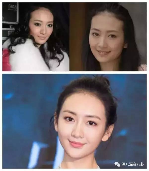 自从割双眼皮不算整容之后，娱乐圈不微调的女演员是真·不存在