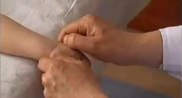 孩子湿疹怕用药有激素,不妨试试这几个穴位