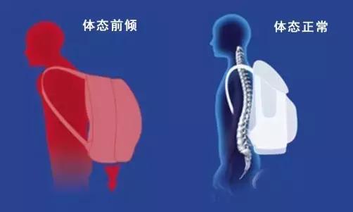 小米科技小书包,小米米兔书包几代比较好