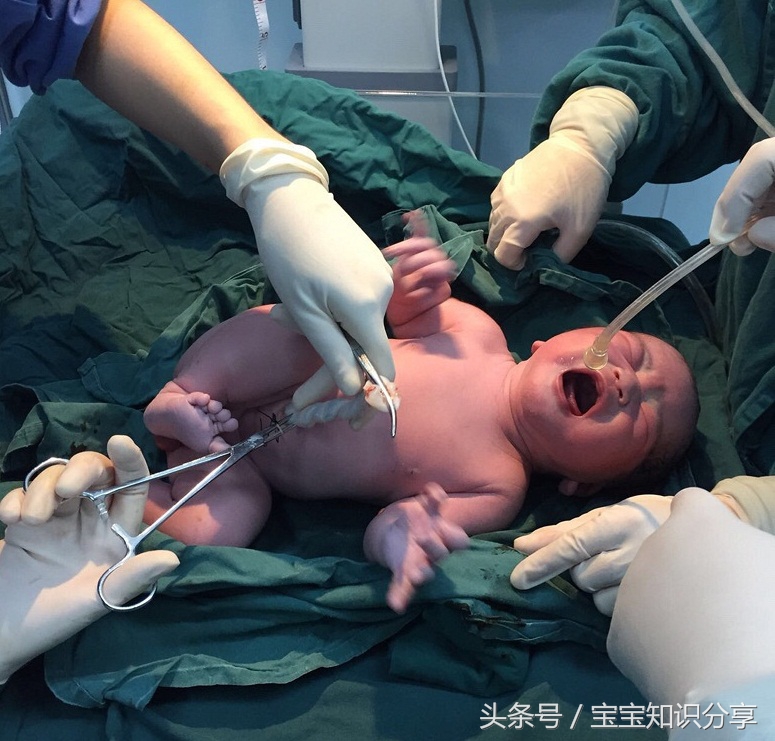 胎儿七斤左右怎么顺产,顺产7天复查b超单子