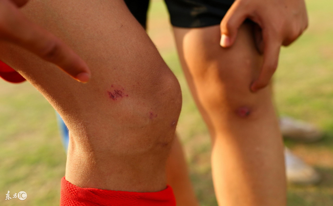 黄博文骑车摔伤,黄博文受伤巴萨