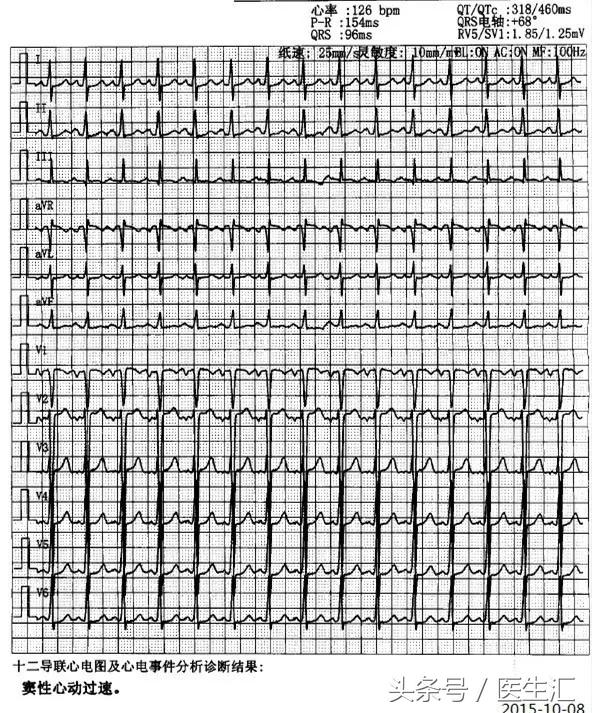 25岁能得心脏病吗,20岁就得了心衰