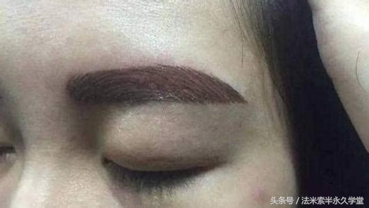 纹唇后的晕色期是什么意思,眉眼凹陷怎么修复