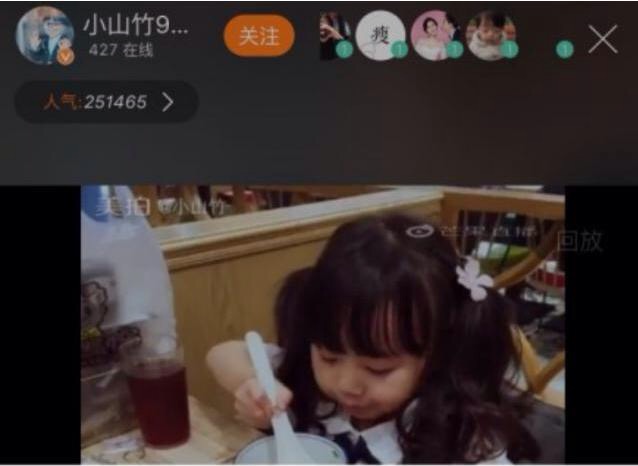 邓伦晒伤胳膊，网友重点跑偏：手毛有点多