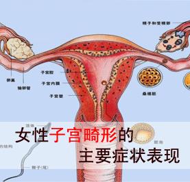 备孕妈妈注意预防——子宫畸形