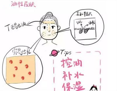 毛孔粗大黑头粉刺闭口的原因,黑头粉刺毛孔粗大怎么调理