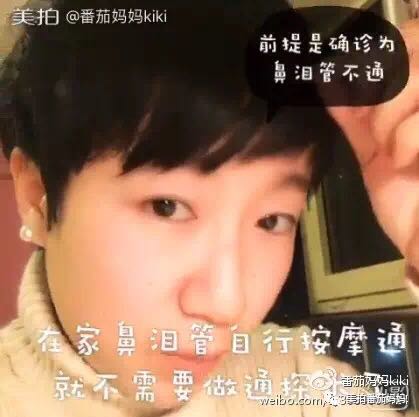 宝宝眼睛都是眼屎粘住了,宝宝眼睛被黄色眼屎糊住