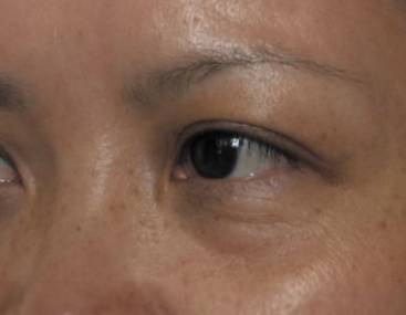 抽烟变丑如果戒了多久可以恢复,吸烟导致严重毁容的图片