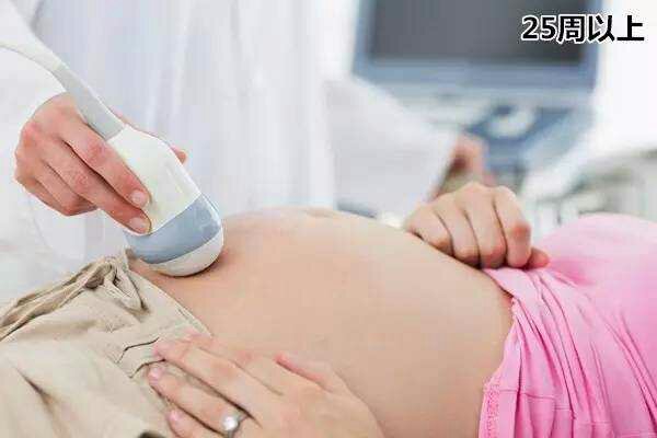 男的会接受女朋友打胎吗,你会建议你的女朋友打胎吗