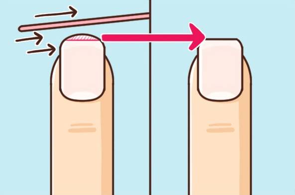 剪指甲的时候为什么会飞出去,为什么剪指甲指甲会乱飞