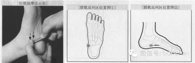 足部子宫反射区出问题怎么治疗,妇科脚底穴位反射区在哪图片