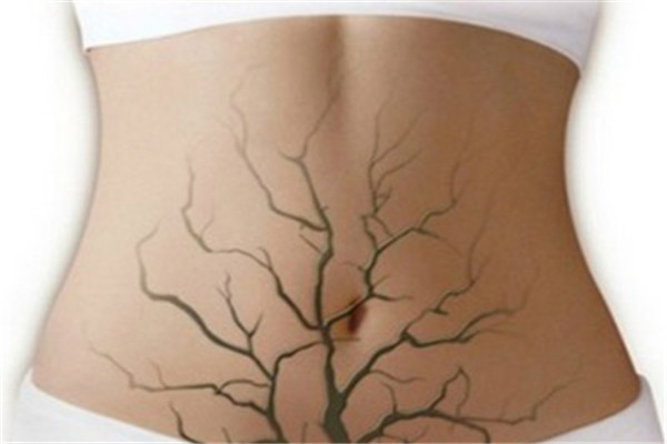 选择试管婴儿的好处有哪些,试管婴儿挑选的胚胎优于自然受孕