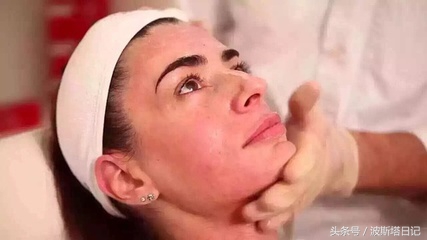 mts微针和美容仪哪个好,mts美容效果