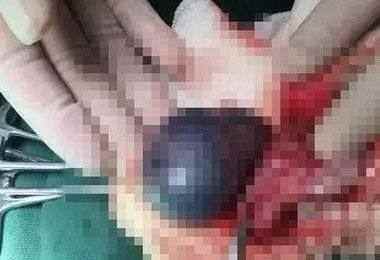 男孩贪玩结果被妈妈砸碎了平板,小男孩贪玩被机器绞断了手臂结局