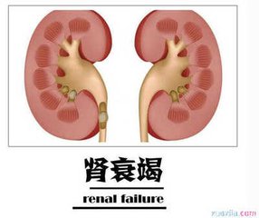 肾病治疗难易程度大排名，你会排第几呢？第一有点惨！