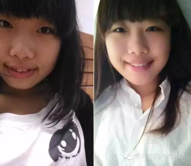 她们说||那些年整牙吞下的血和泪,终于换来最开怀的大笑