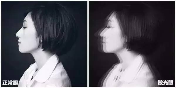 老生常谈的散光你真的了解全面吗,散光是角膜的问题还是晶状体问题