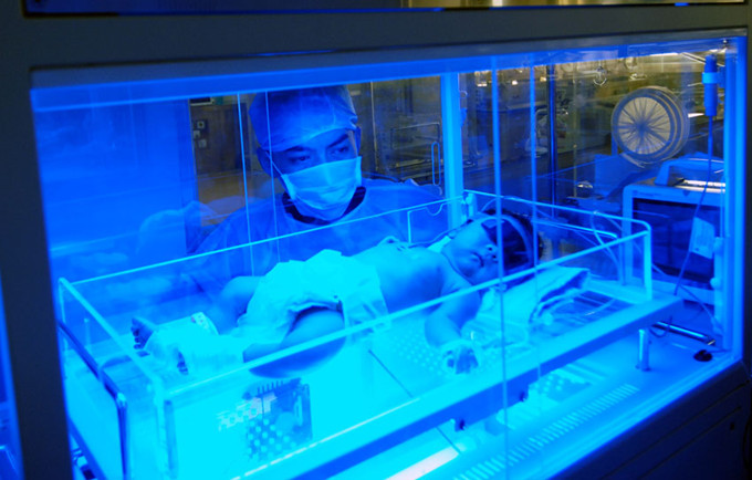 新生儿黄疸正常值表,新生儿黄疸如何避免