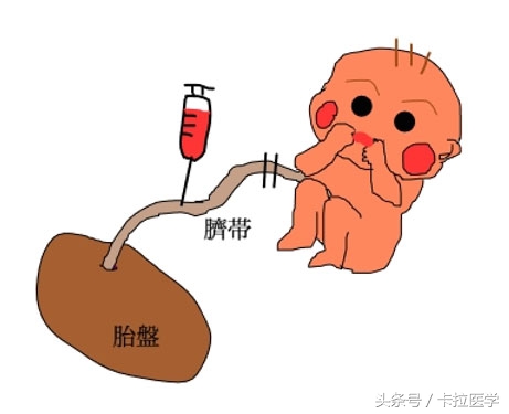 日本一诊所非法使用脐带血狂赚中国人钱，但是什么是脐带血？