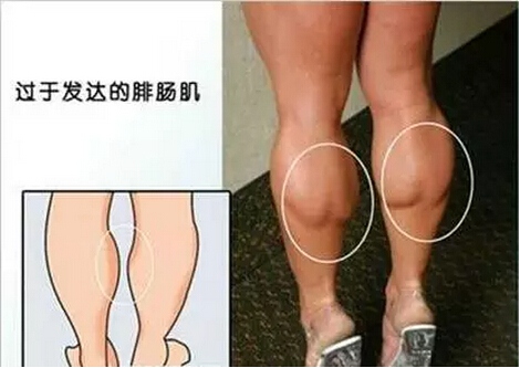 怎么判断两条腿的力量,怎么用手判断腿围