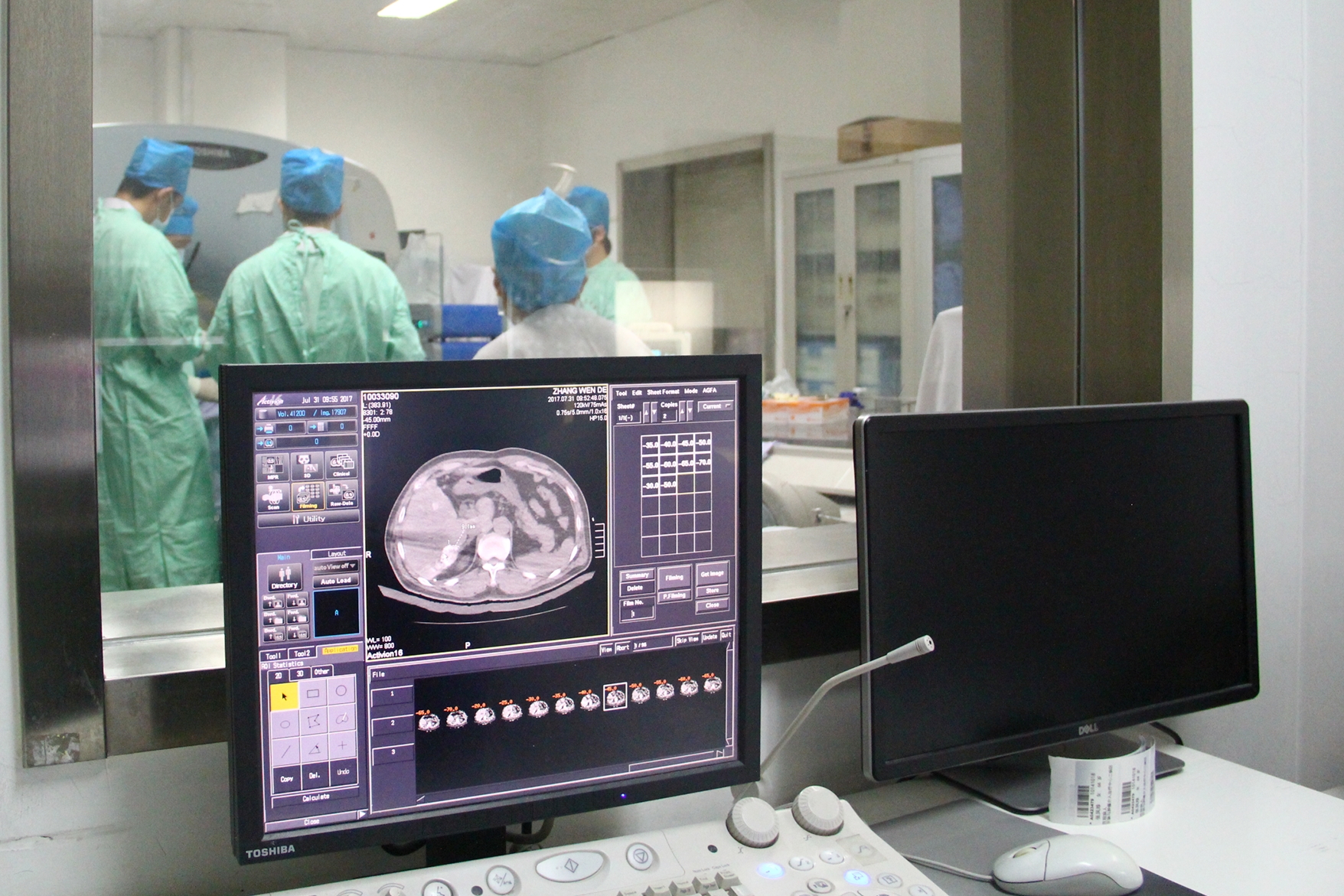 一带一路▪肿瘤微创健康中国行公益活动助肝癌患者重回健康