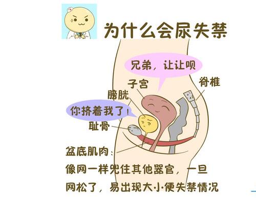 尿失禁发生的原因有哪些,尿失禁由什么原因引起的