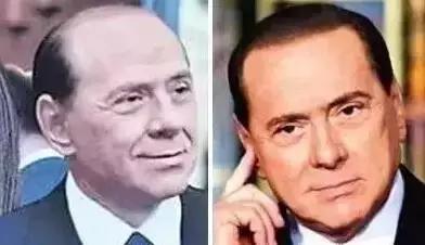 目前关于脱发的最新治疗方法,什么方法治疗脱发效果好