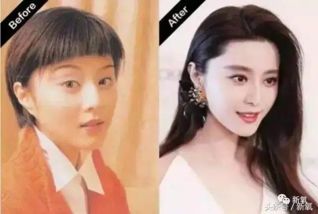 杨紫微整前后容颜对比,杨紫瘦了吗