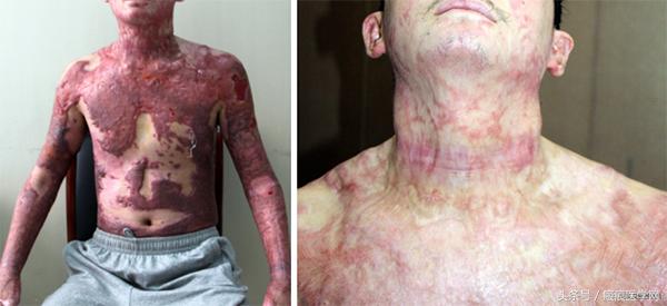 三个动作帮你解决脖子不适,一招教你解决脖子问题